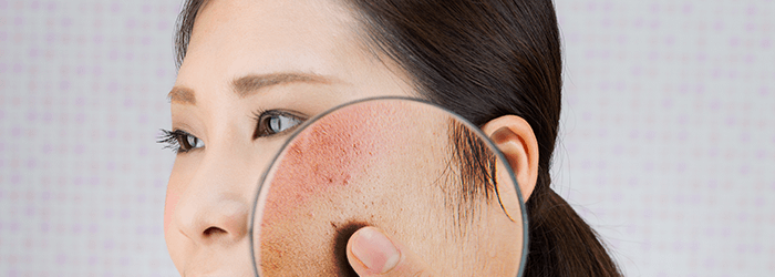 治療院業界がこれからホームページの広告で注意すること